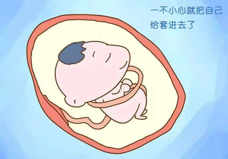 640.png