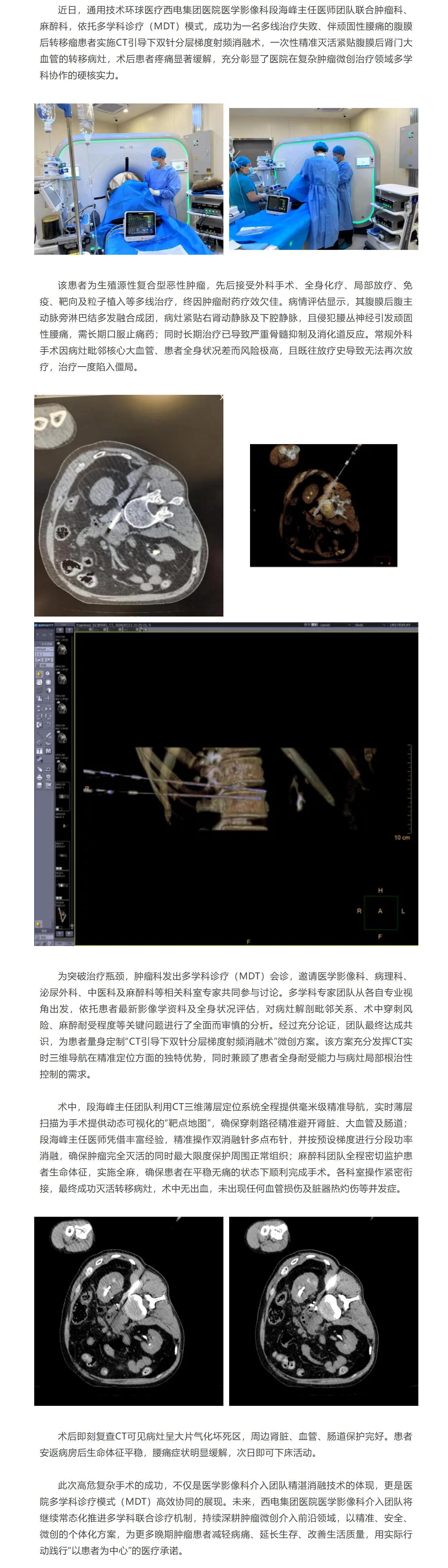 多学科联手“狙击”瘤灶！西电集团医院医学影像科成功实施微创消融术为晚期肿瘤患者破解疼痛困局.jpg