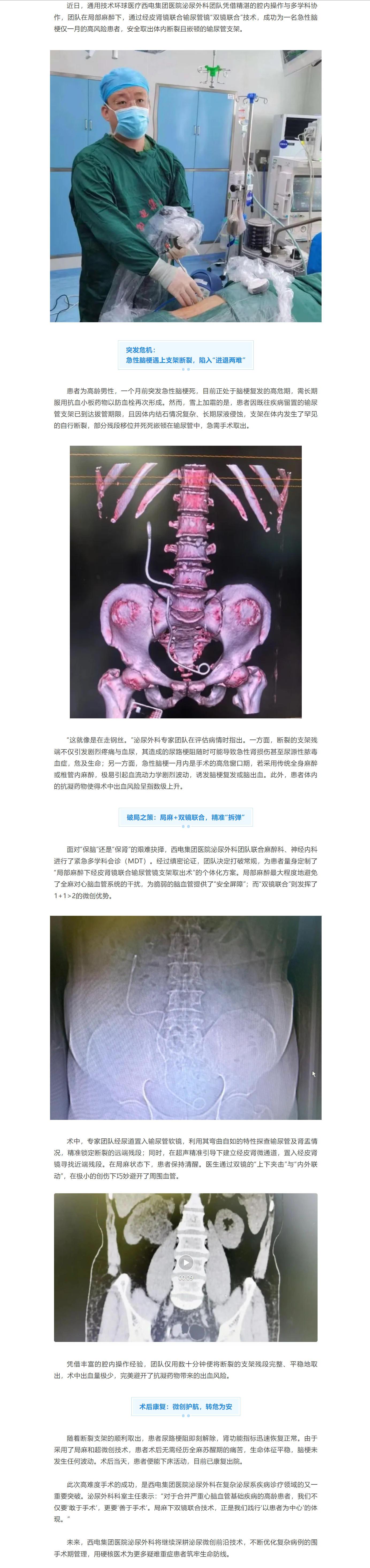 破局高危禁区！西电集团医院泌尿外科局麻下“双镜联合”成功为急性脑梗高危患者取出断裂输尿管支架.jpg