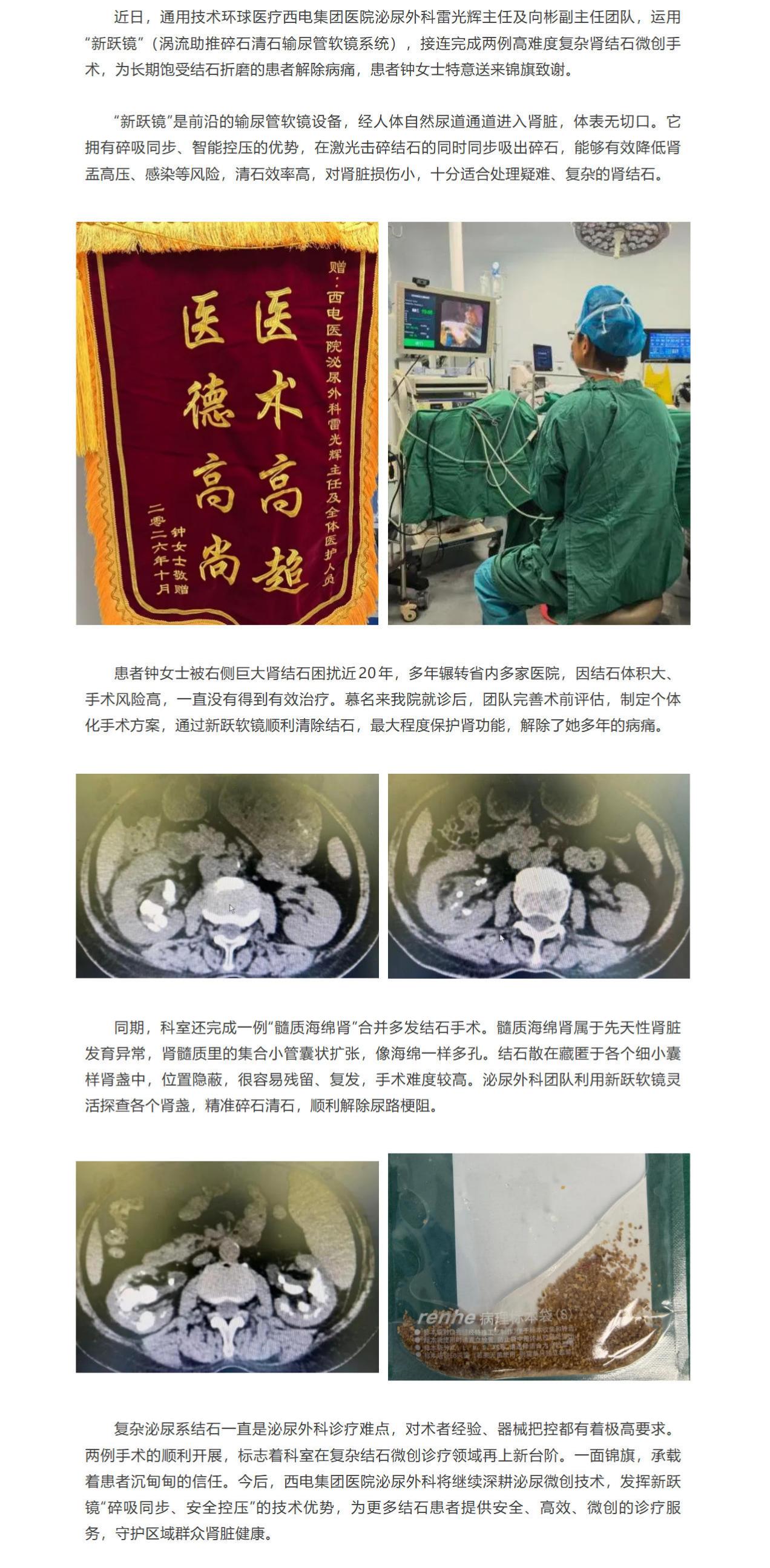 碎吸同步，精准保肾！西电集团医院泌尿外科运用“新跃镜”攻克两例高难度复杂肾结石.jpg